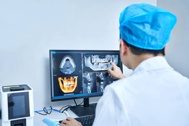 Best Emergency Root Canal Treatment in Brooklyn Park, MN